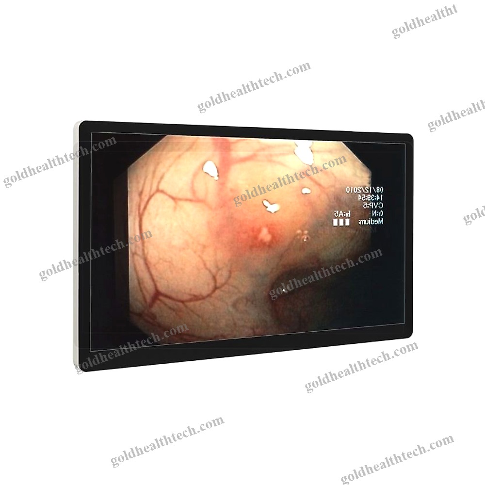 Endoscopy Display