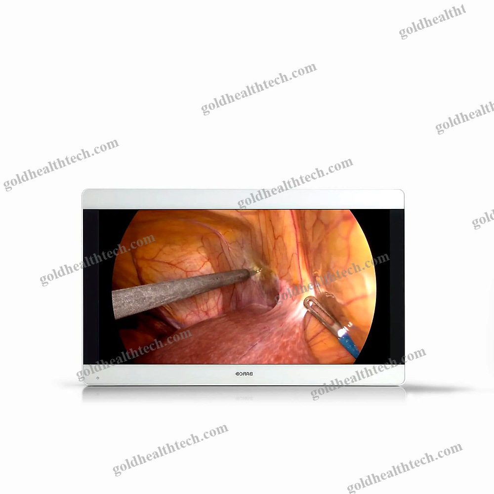 Endoscopy Display