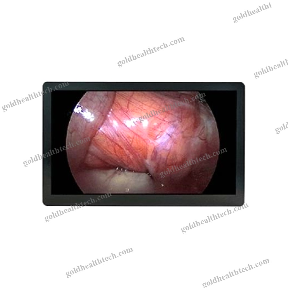 Endoscopy Display
