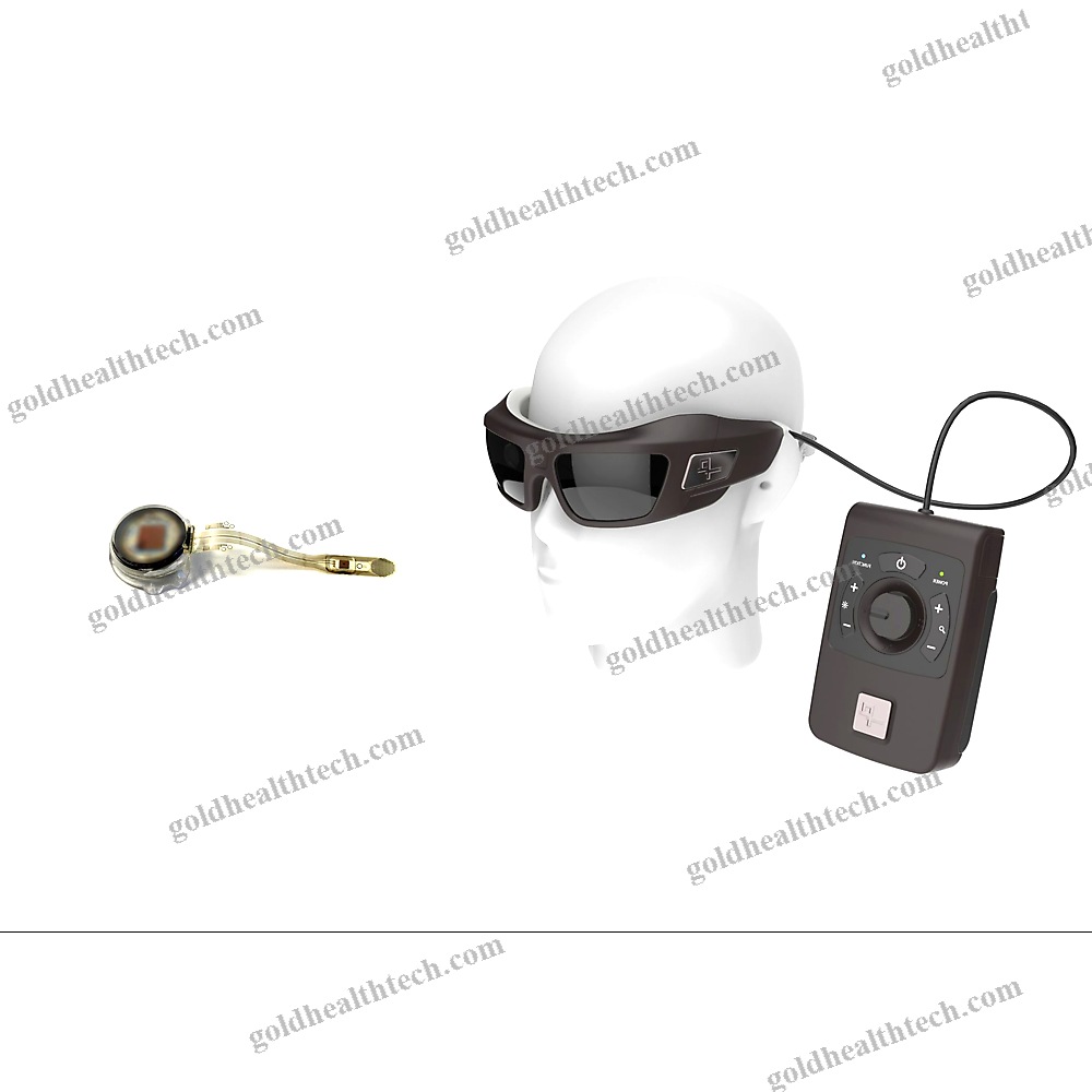 Epiretinal Implant
