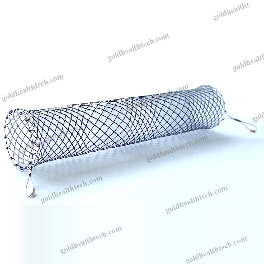 Esophageal Stent 1