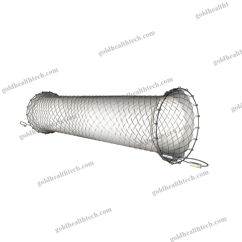 Esophageal Stent