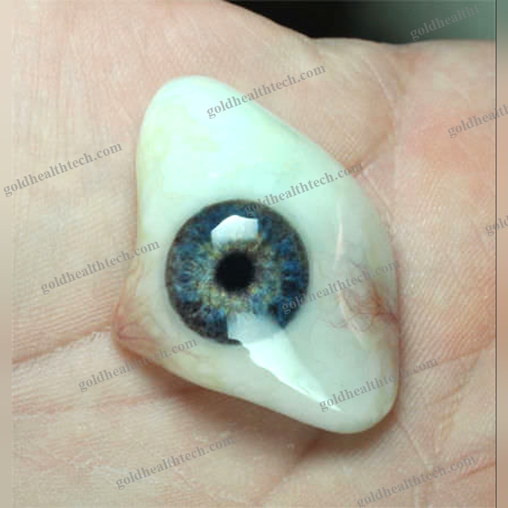 Eye Cosmetic Prosthesis