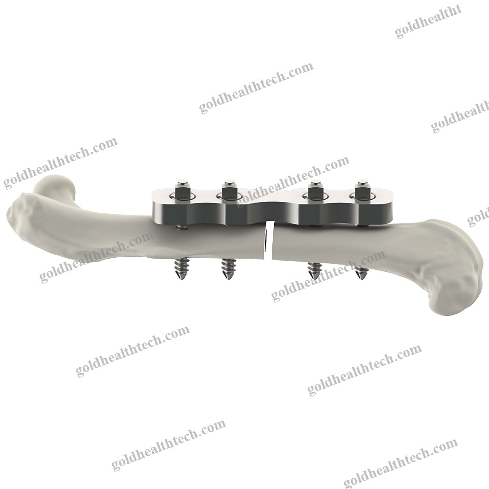 Femur Veterinary Bone Plate
