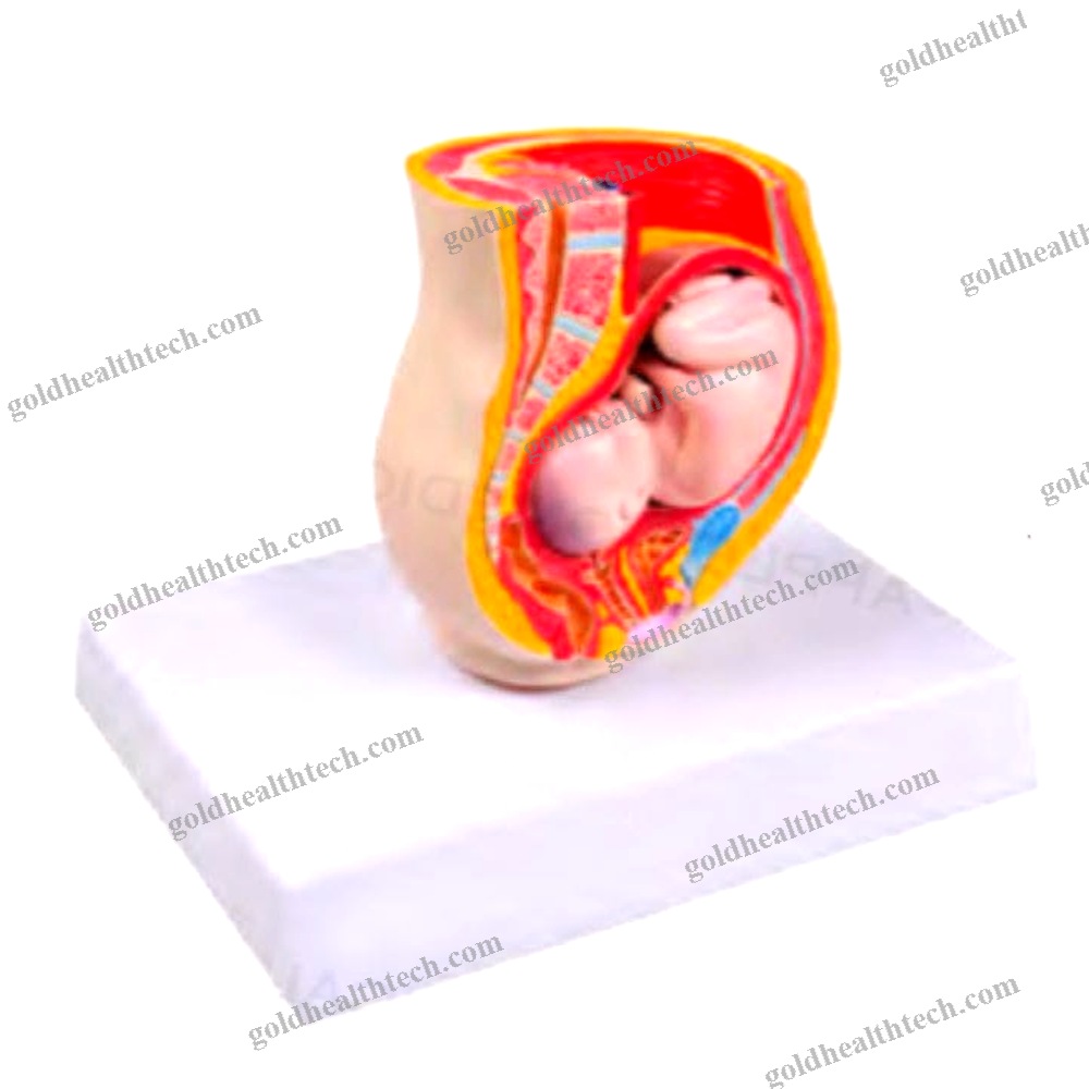 Fetus Model
