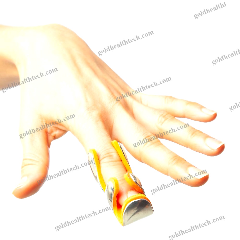 Frog Finger Splint
