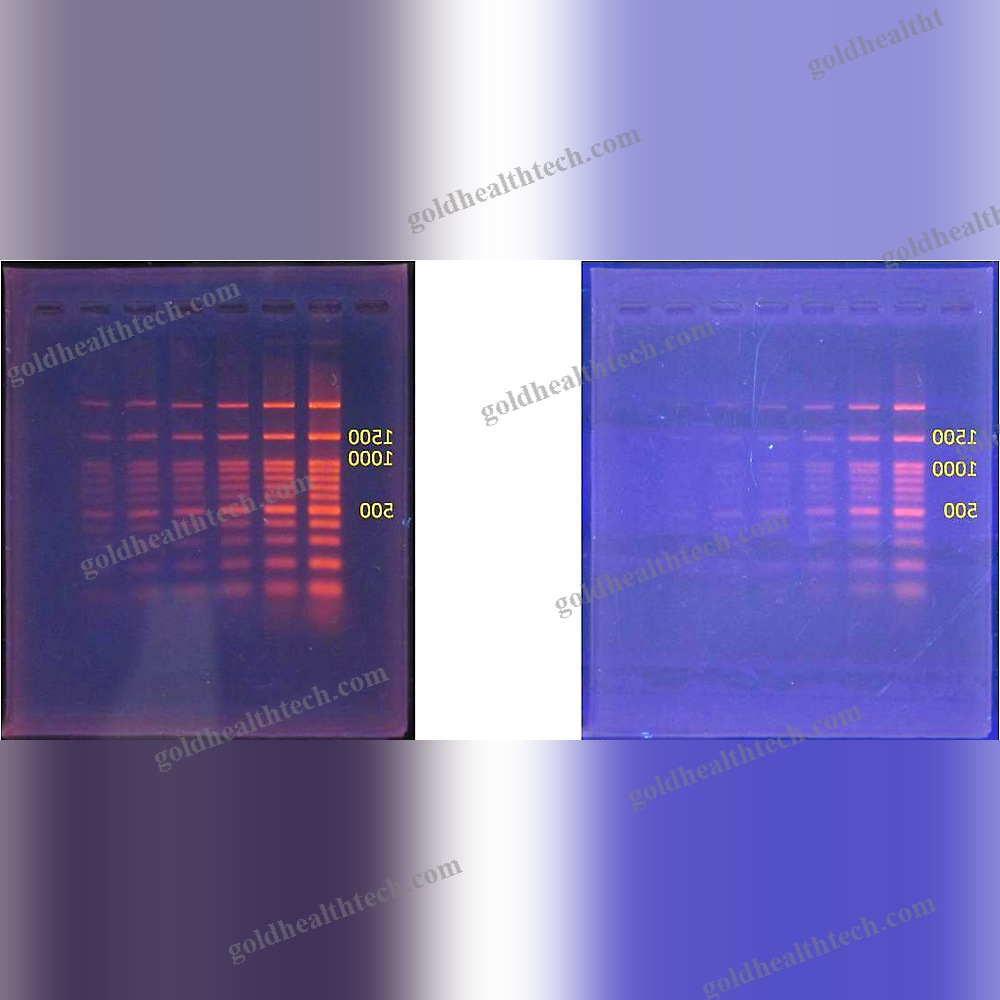 Gel Documentation System Transilluminator 1
