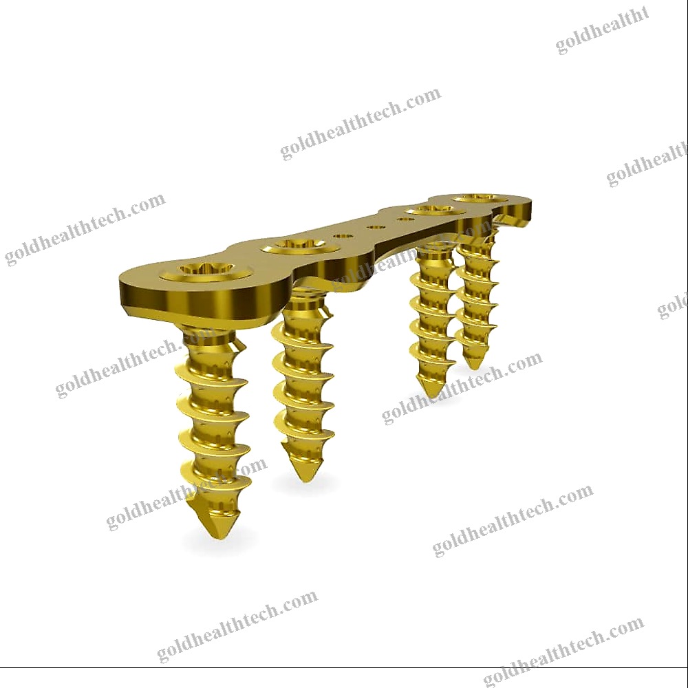 Hallux Valgus Arthrodesis Plate