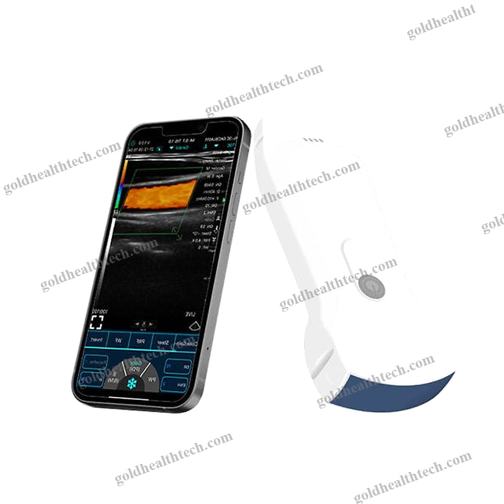 Hand-Held Ultrasound System
