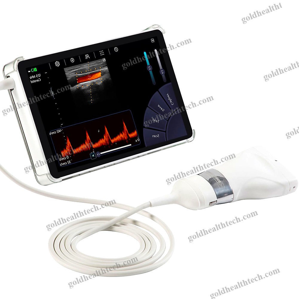 Hand-Held Ultrasound System