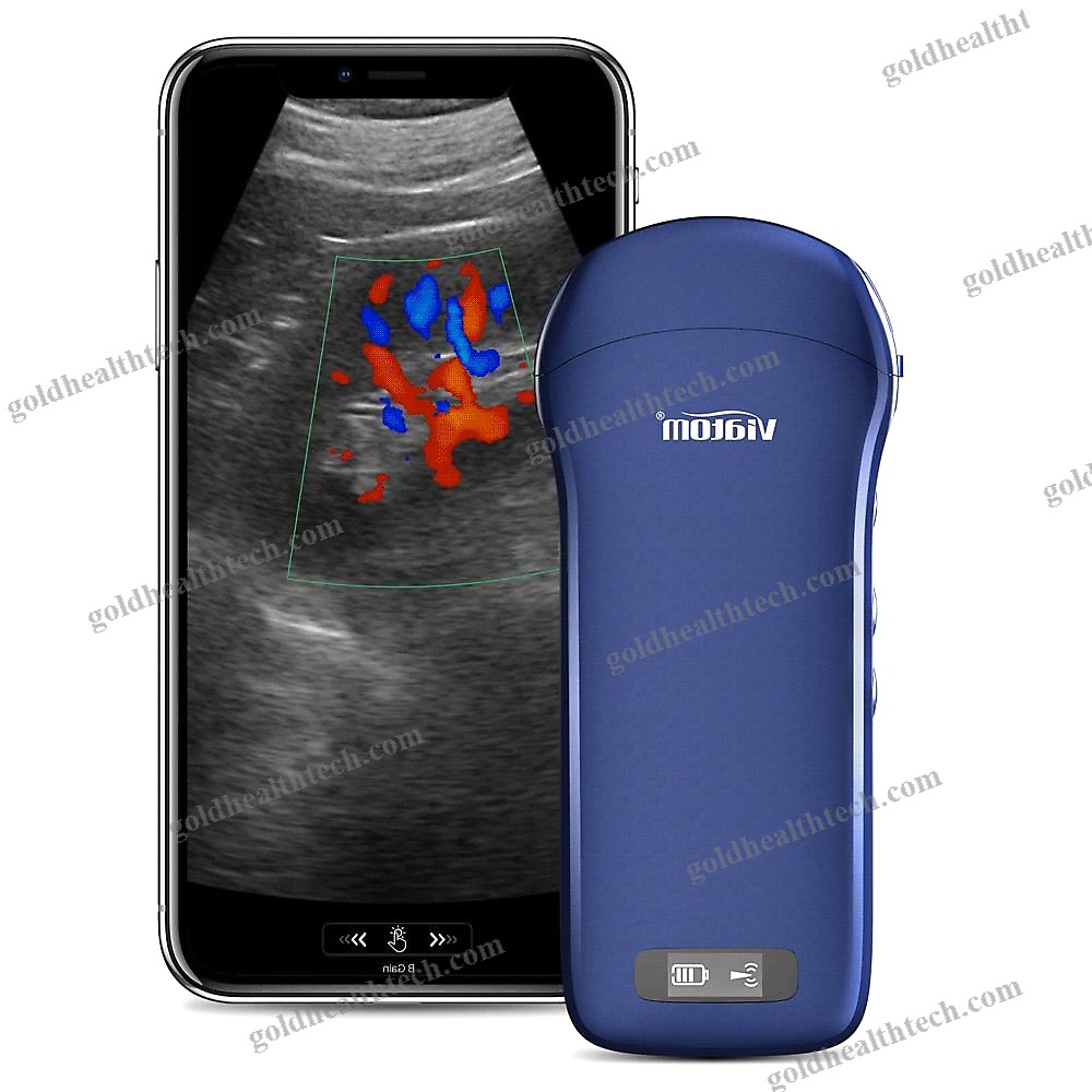 Hand-Held Ultrasound System