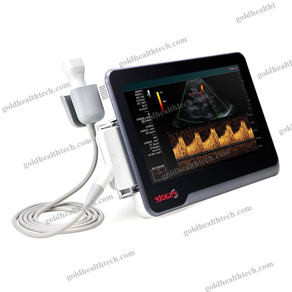 Hand-Held Ultrasound System