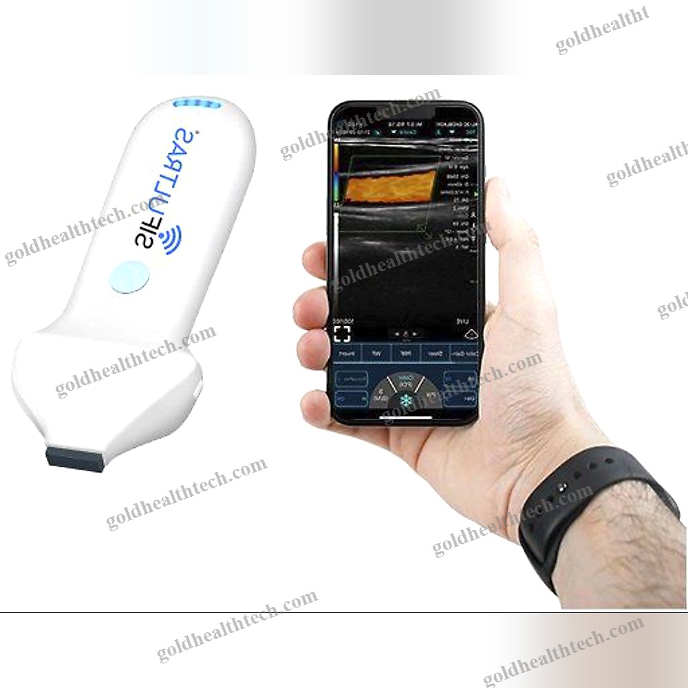 Hand-Held Ultrasound System 1