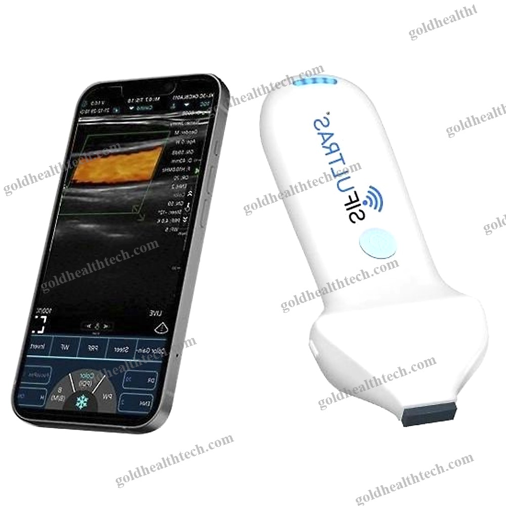Hand-Held Ultrasound System