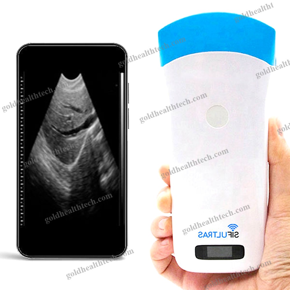 Hand-Held Ultrasound System