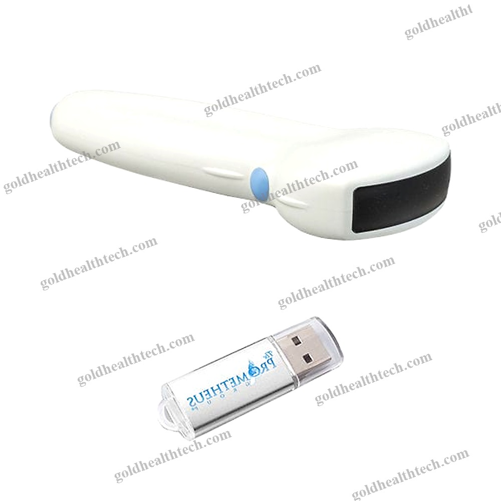 Hand-Held Ultrasound System