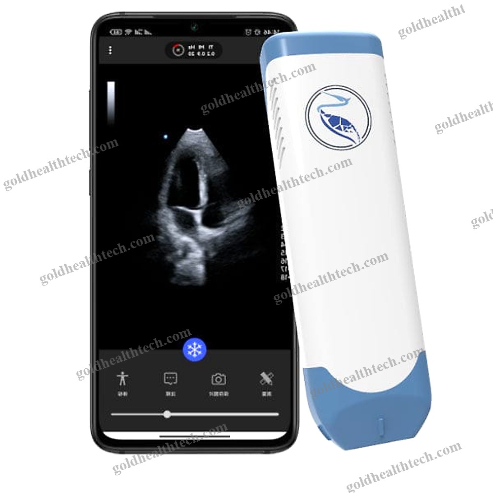 Hand-Held Ultrasound System