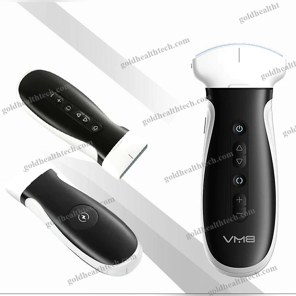 Hand-Held Ultrasound System 1