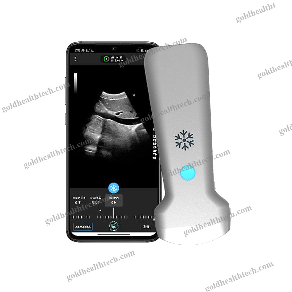 Hand-Held Ultrasound System