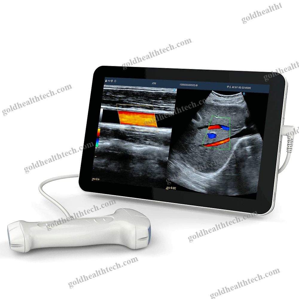 Hand-Held Ultrasound System