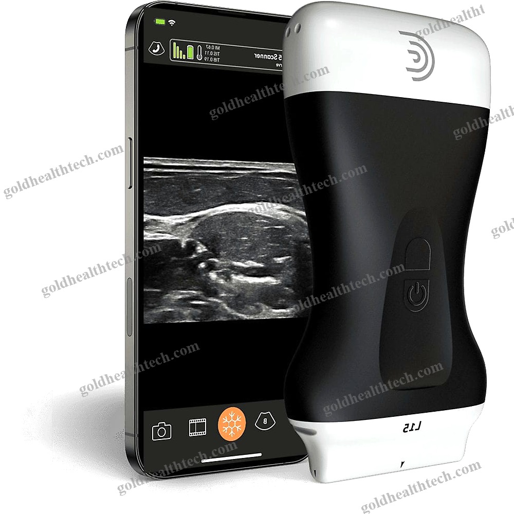 Hand-Held Ultrasound System