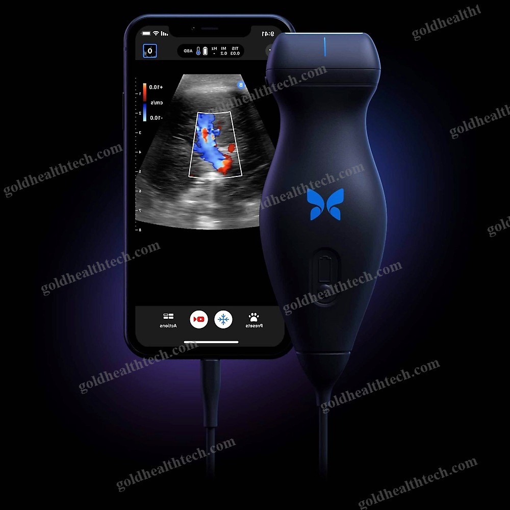 Hand-Held Veterinary Ultrasound System