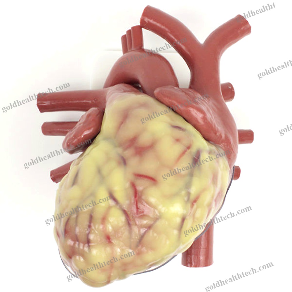 Heart Model