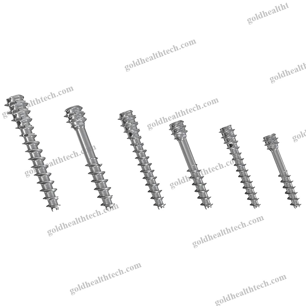 Hindfoot Arthrodesis Screw