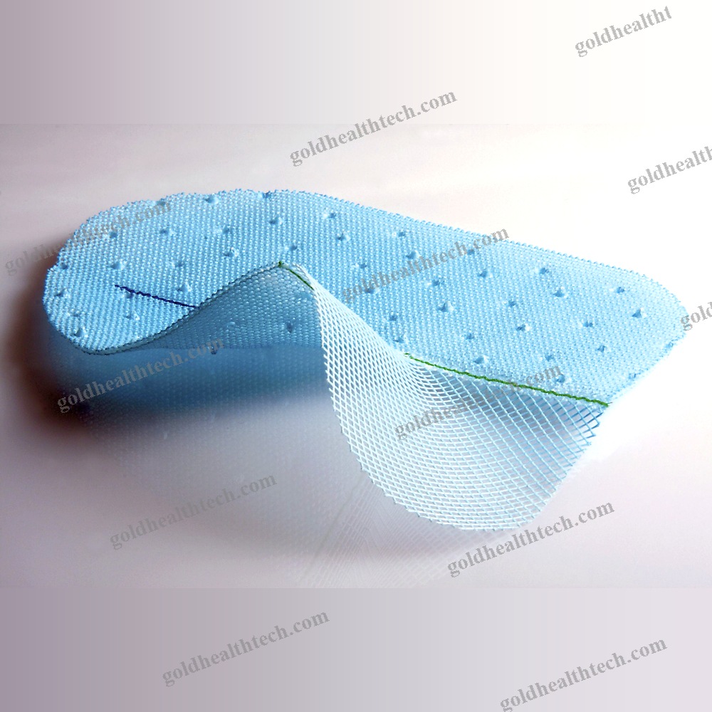 Incisional Hernia Prosthesis