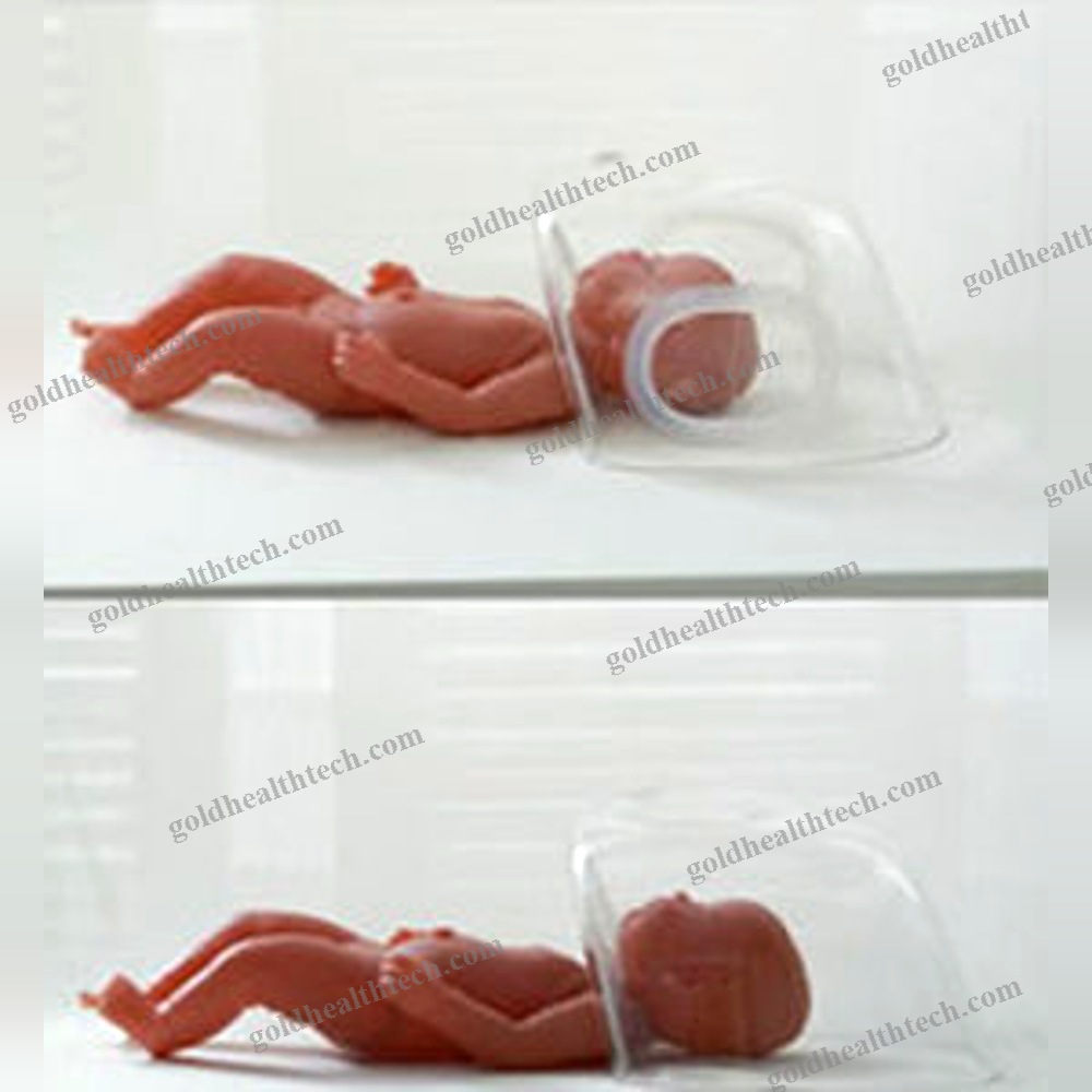 Infant Oxygen Hood