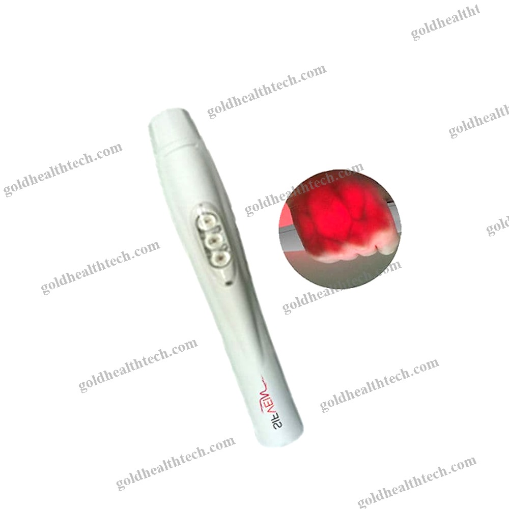 Infrared Vein Viewer