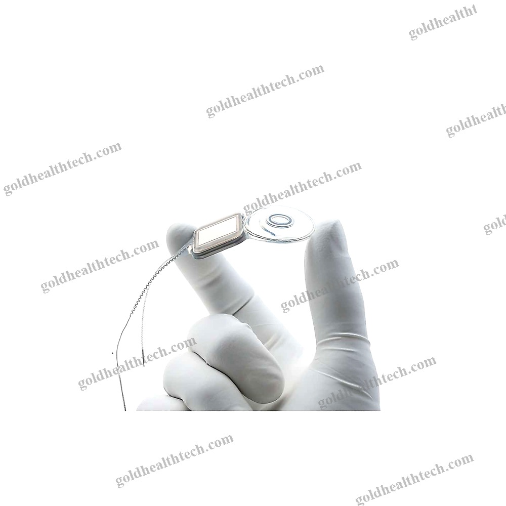 Internal Component Cochlear Implant