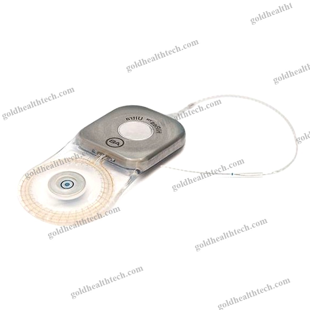 Internal Component Cochlear Implant