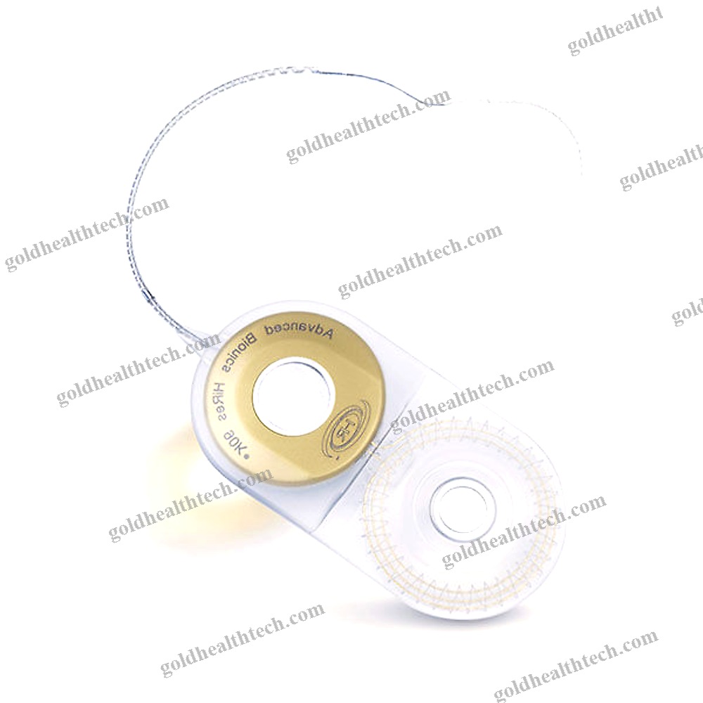 Internal Component Cochlear Implant