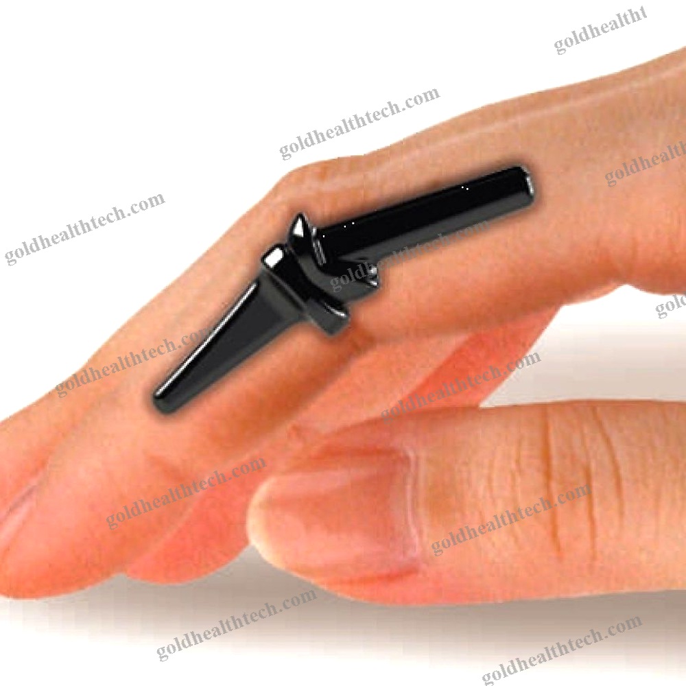Interphalangeal Hand Joint Implant