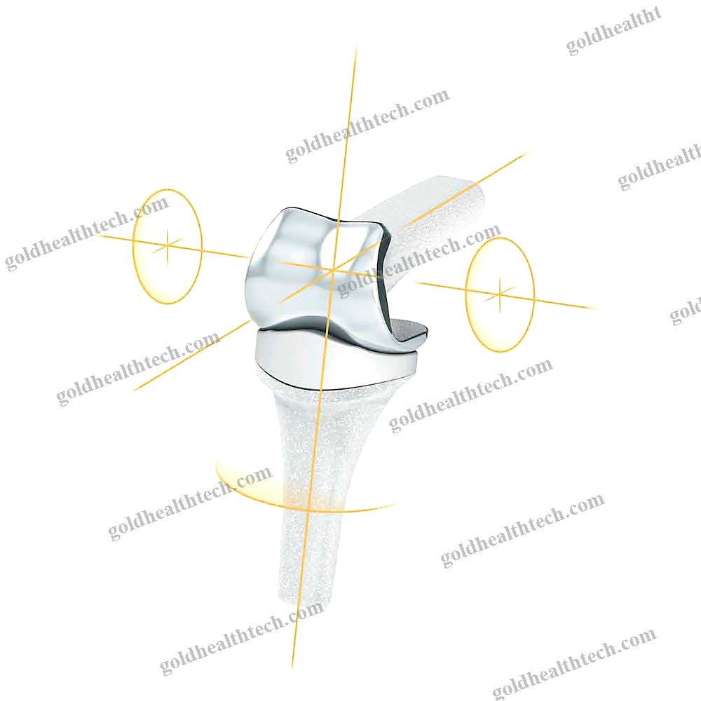 Interphalangeal Hand Joint Implant