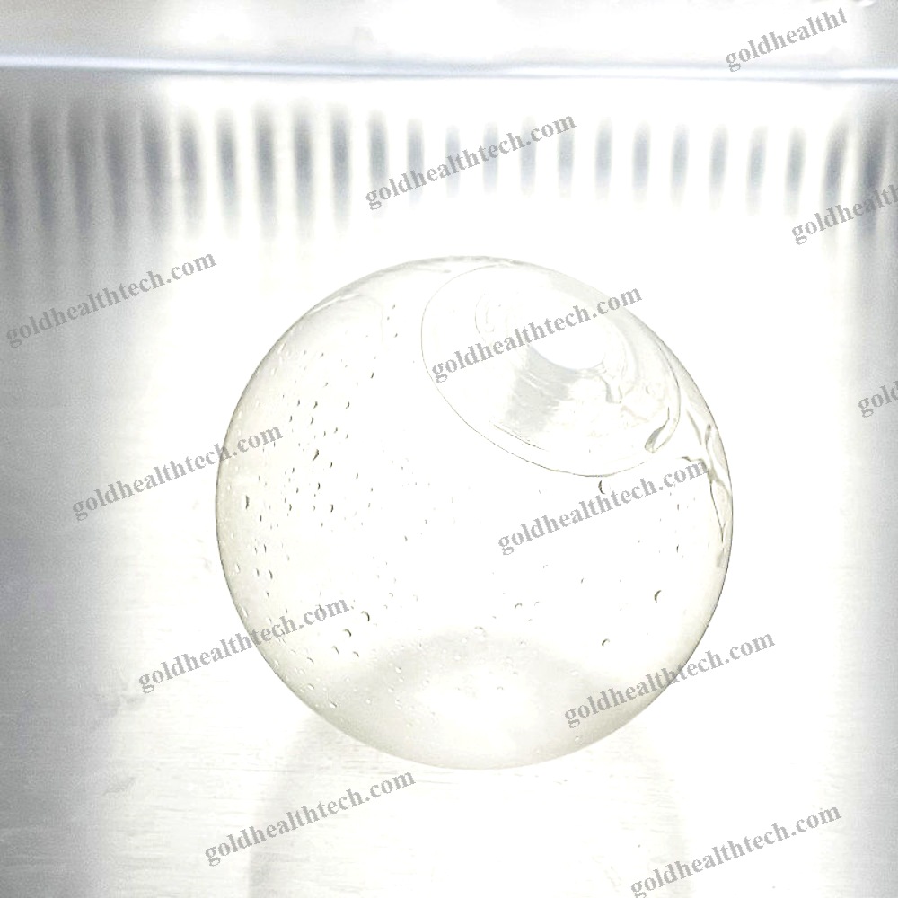 Intragastric Balloon
