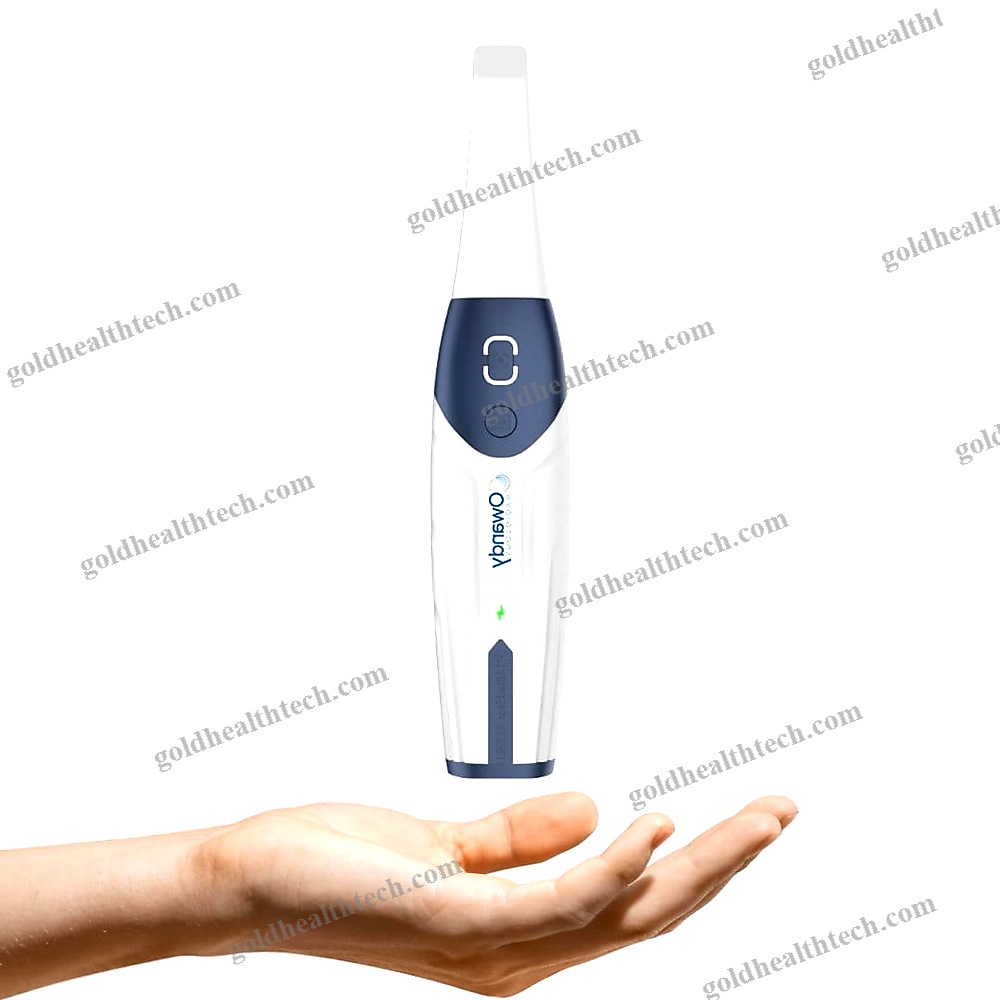 Intraoral 3D Scanner