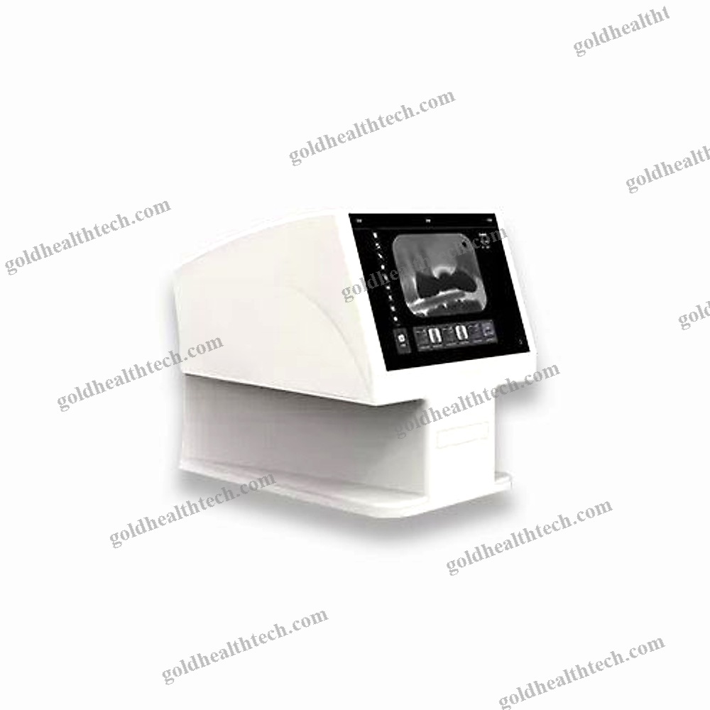 Intraoral Cr Scanner