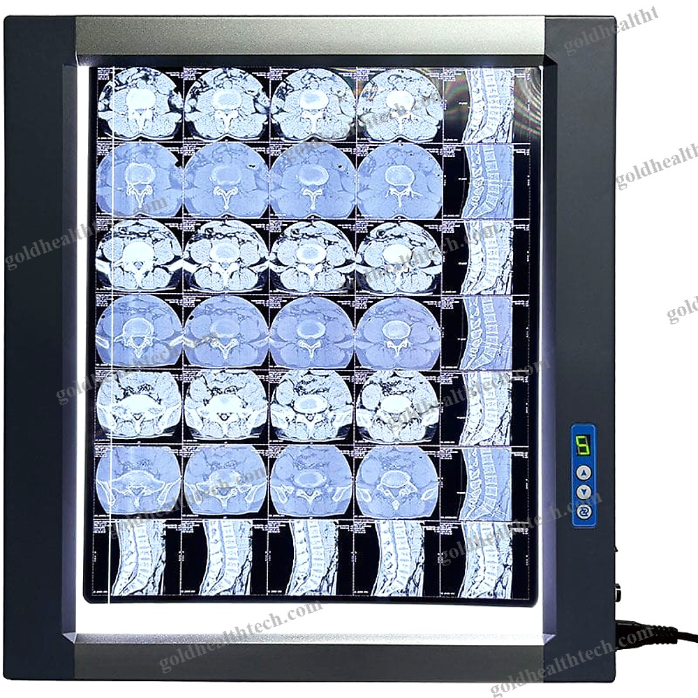 Led X-Ray Film Viewer