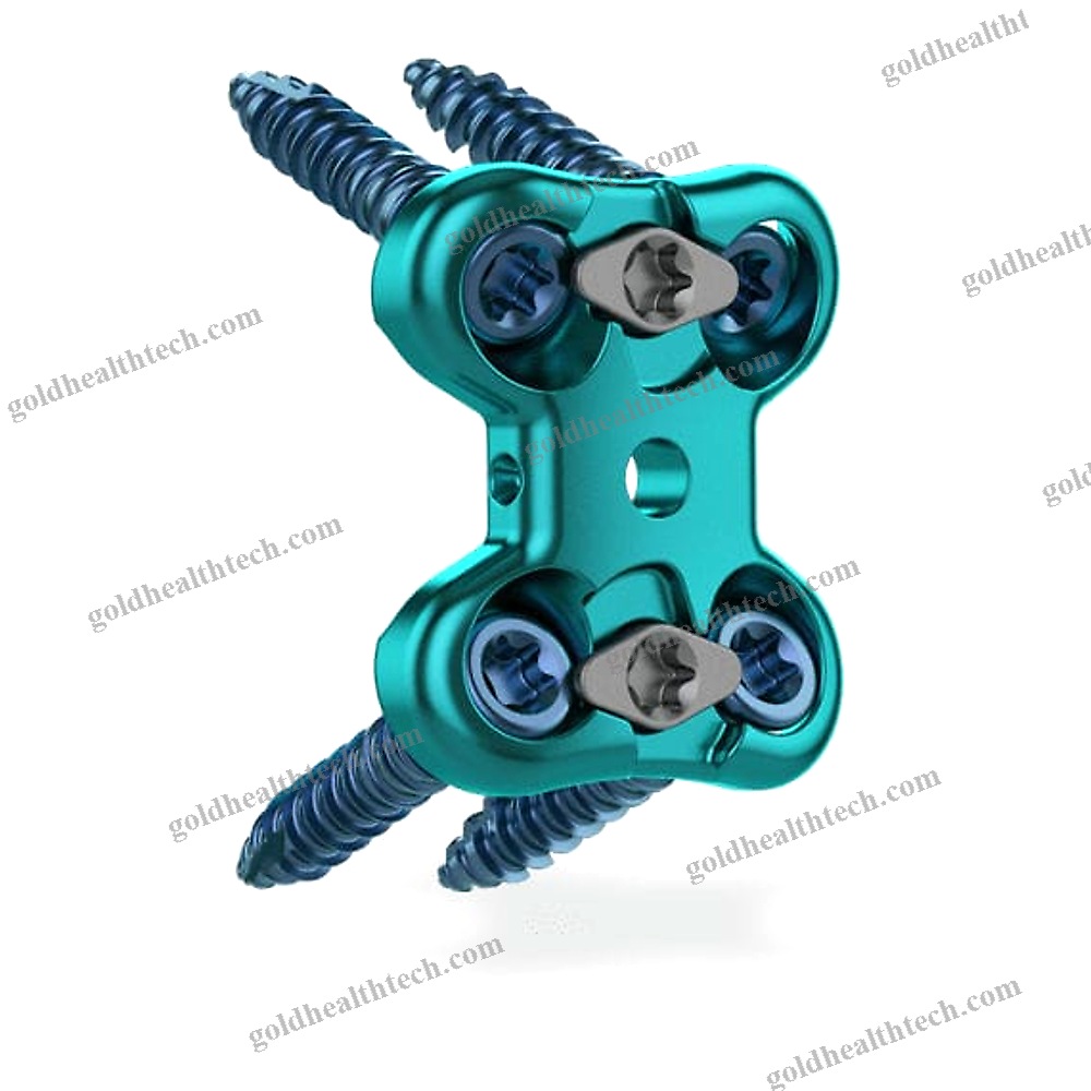 Lumbar Arthrodesis Plate