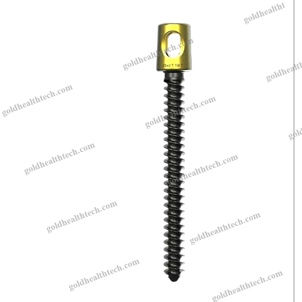 Lumbar-Sacral Vertebra Pedicle Screw