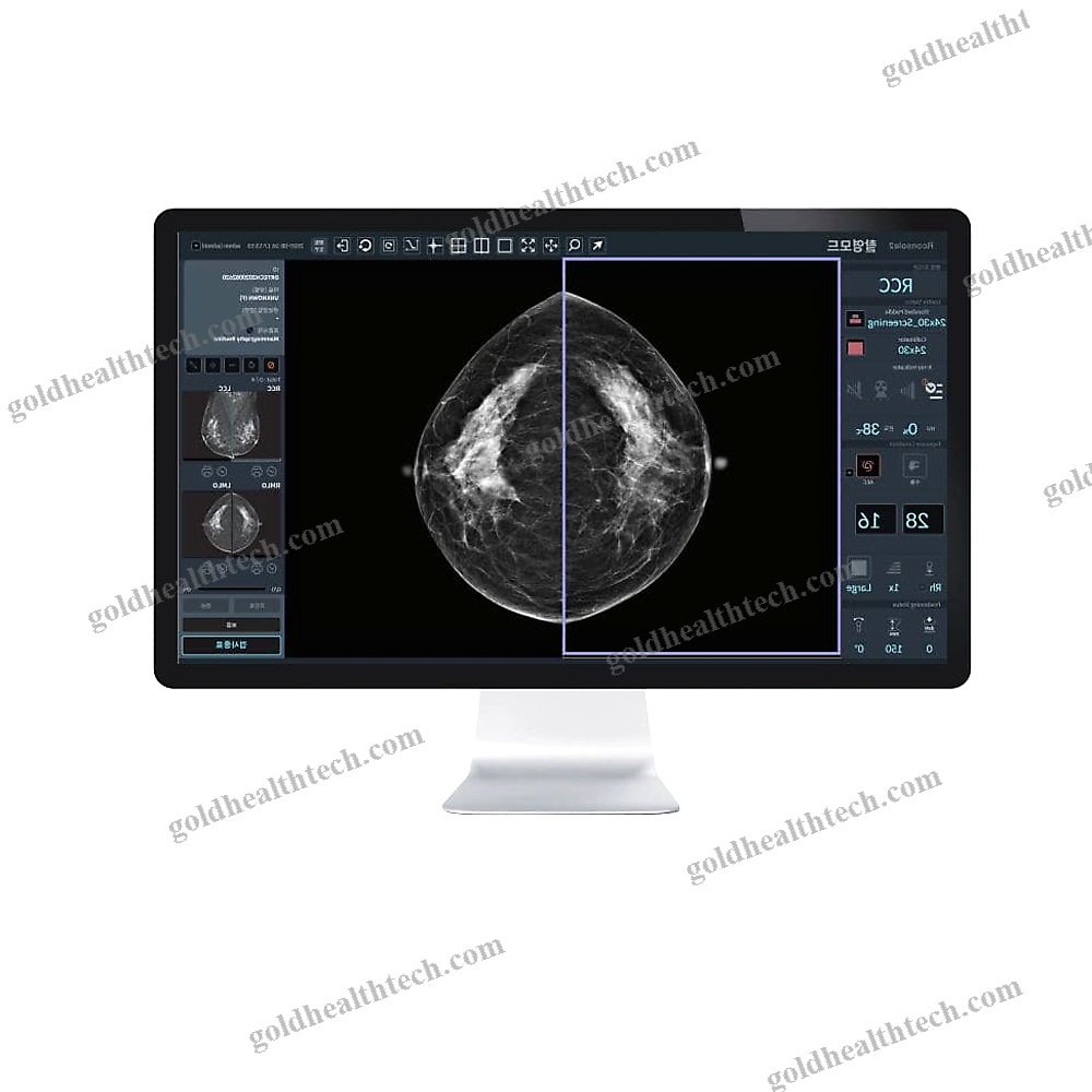 Mammography Software