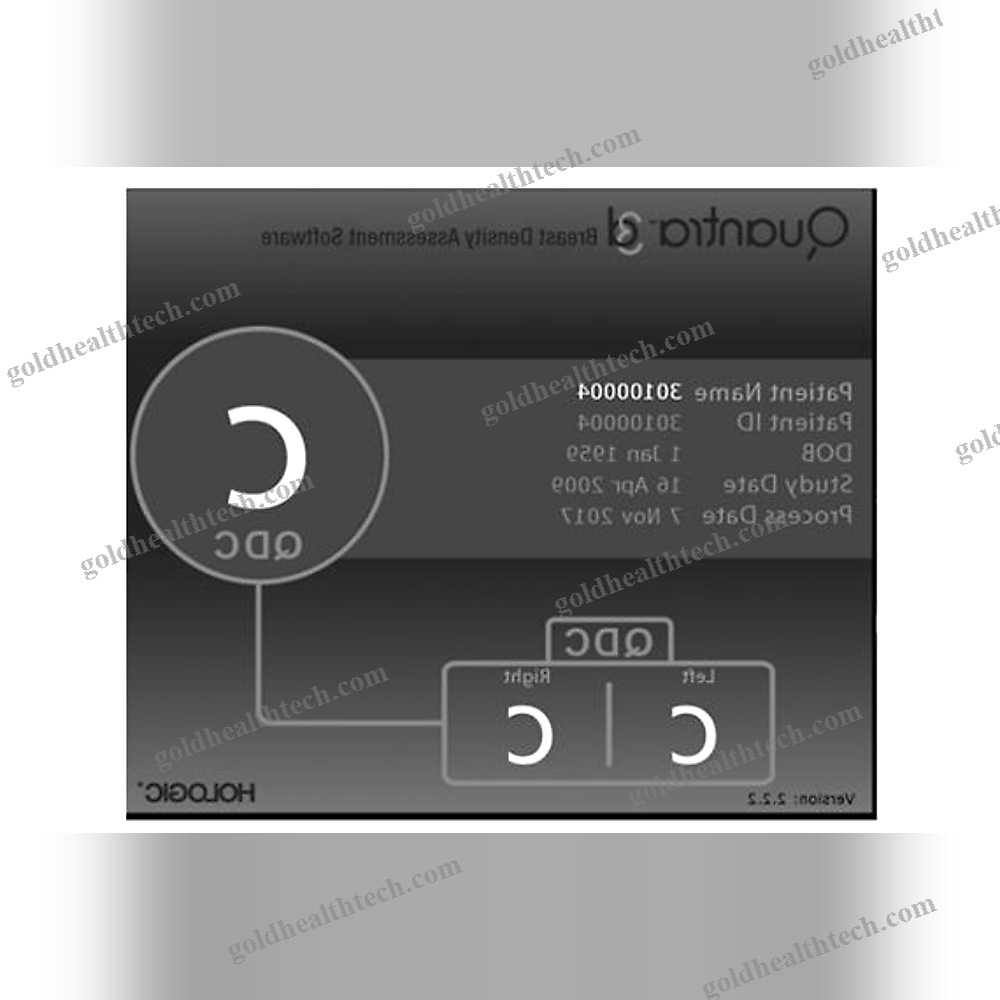 Mammography Software