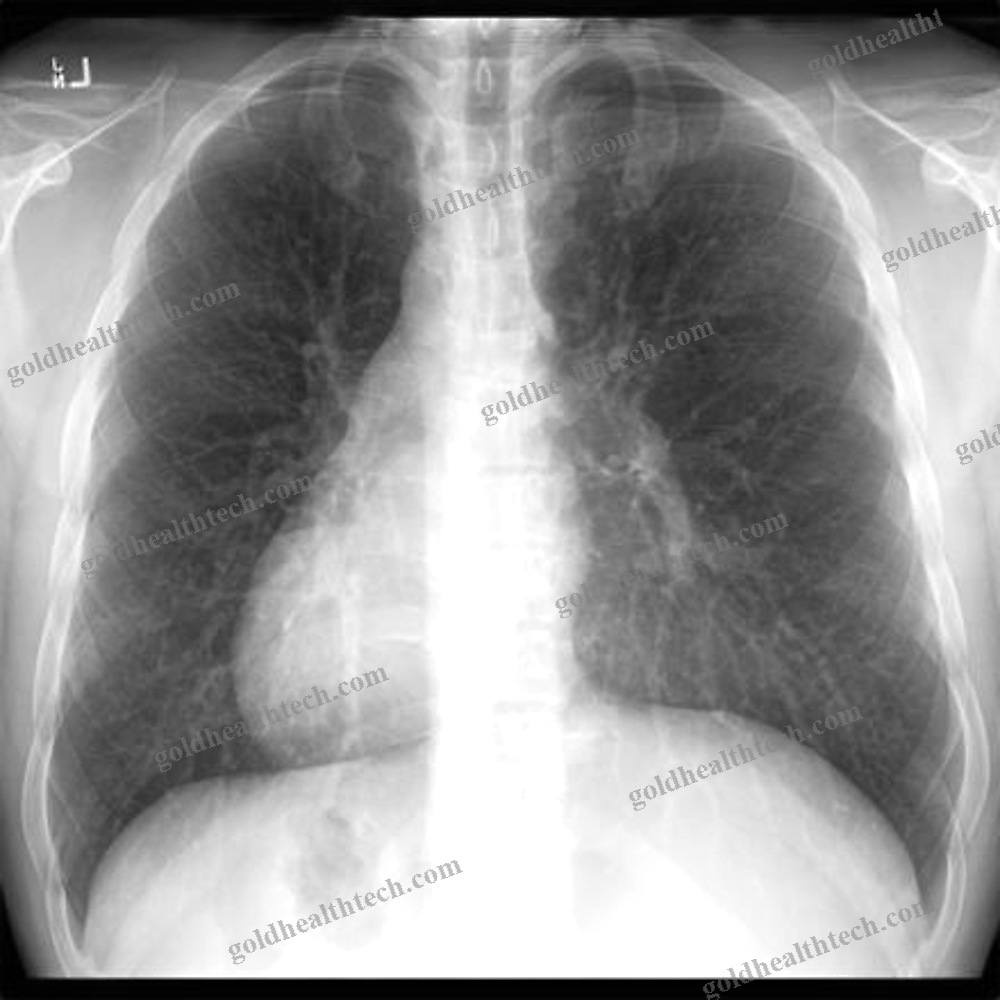 Medical Imaging Ai Platform