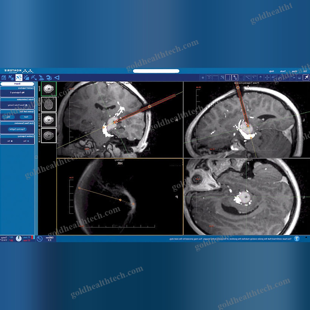 Medical Imaging Software