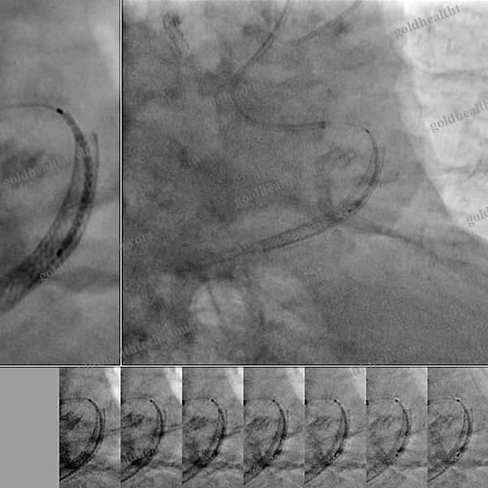 Medical Imaging Software