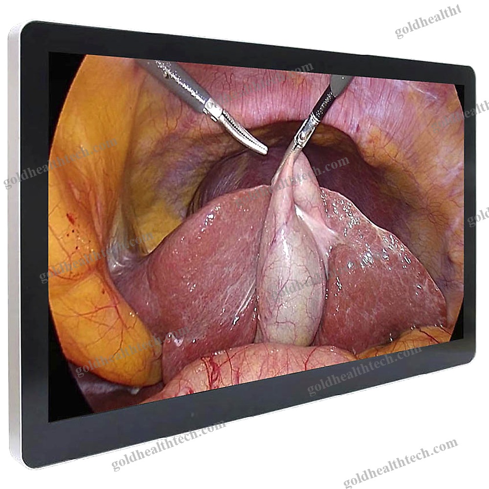 Medical Monitor