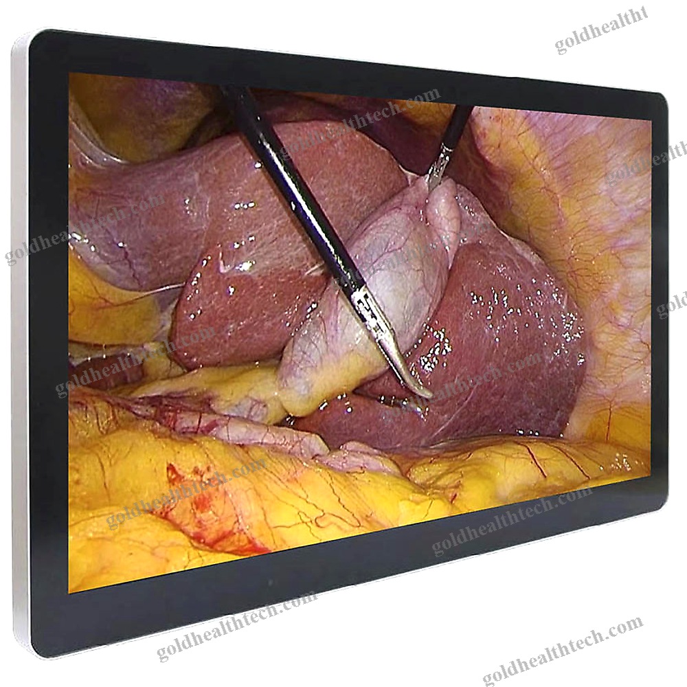 Medical Monitor