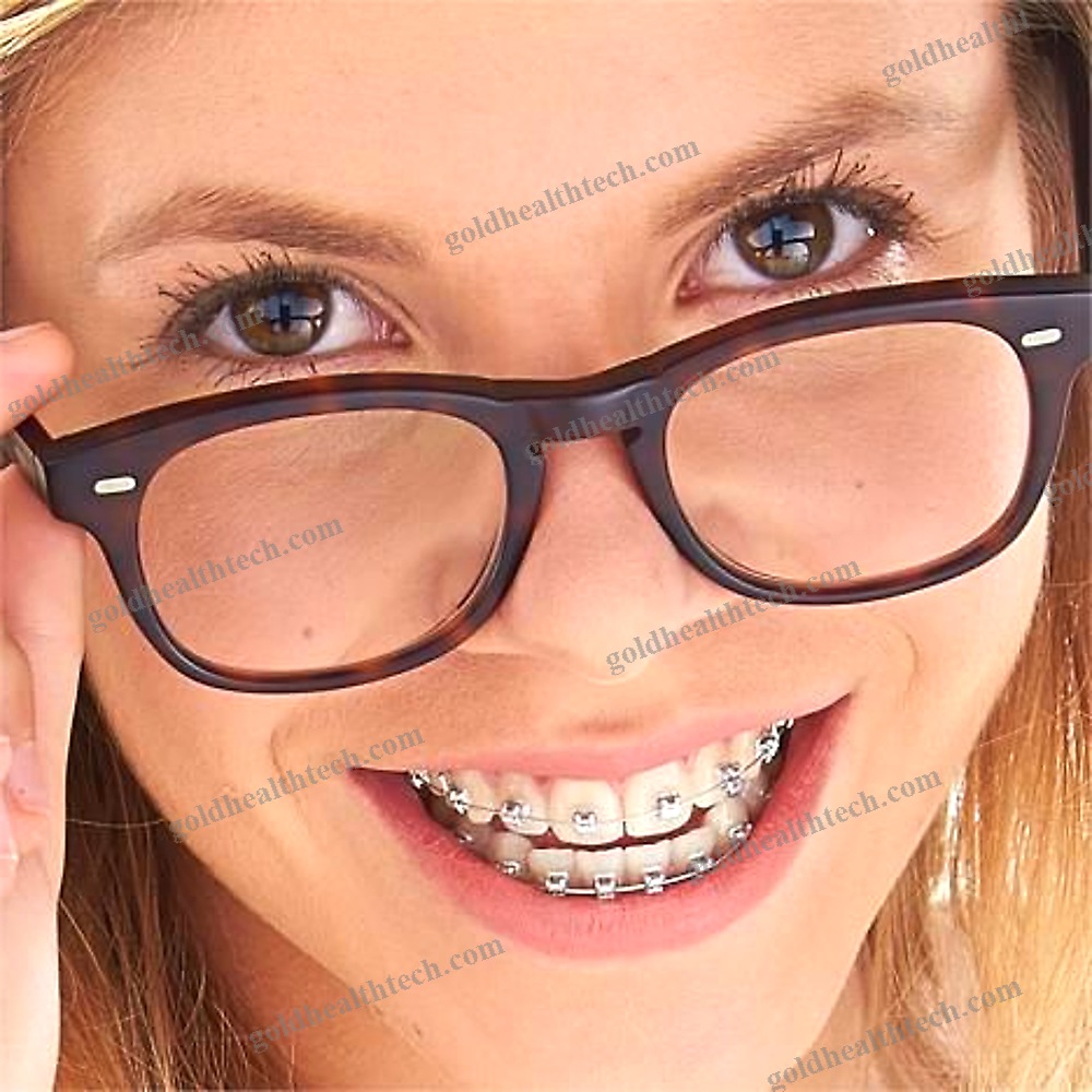 Metal Orthodontic Bracket 1